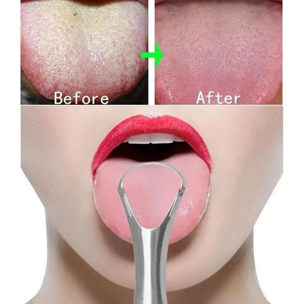 Fresh Breath Tongue Scraper